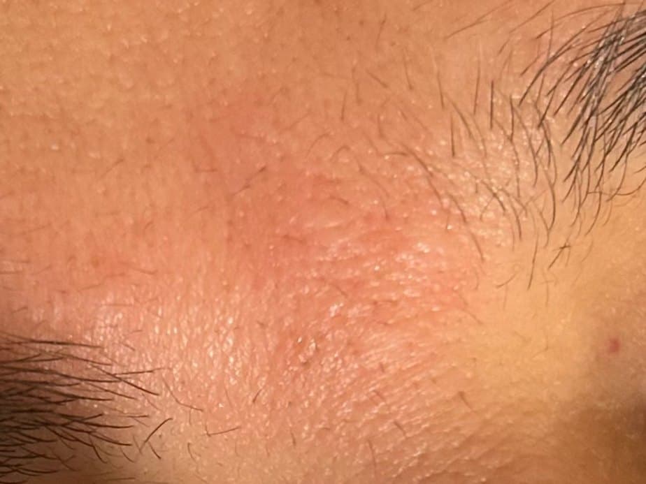 Brows after treatment